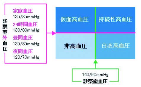 仮面高血圧